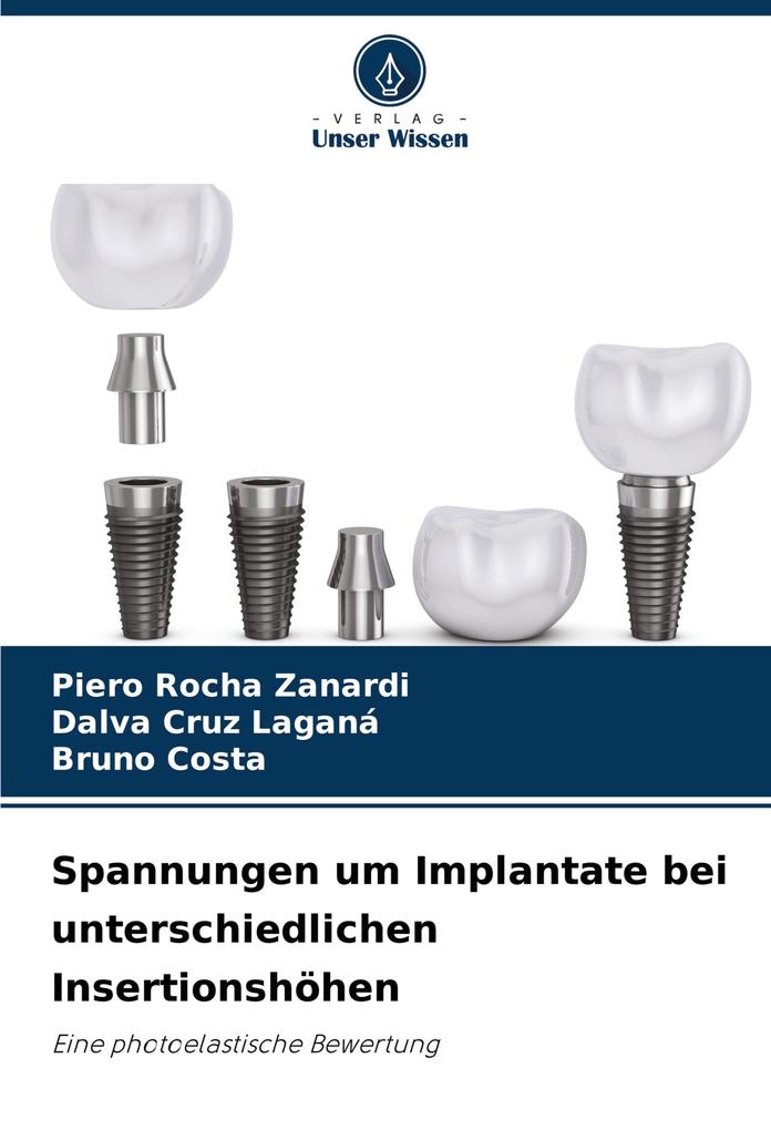 Spannungen um Implantate bei unterschiedlichen Insertionshöhen