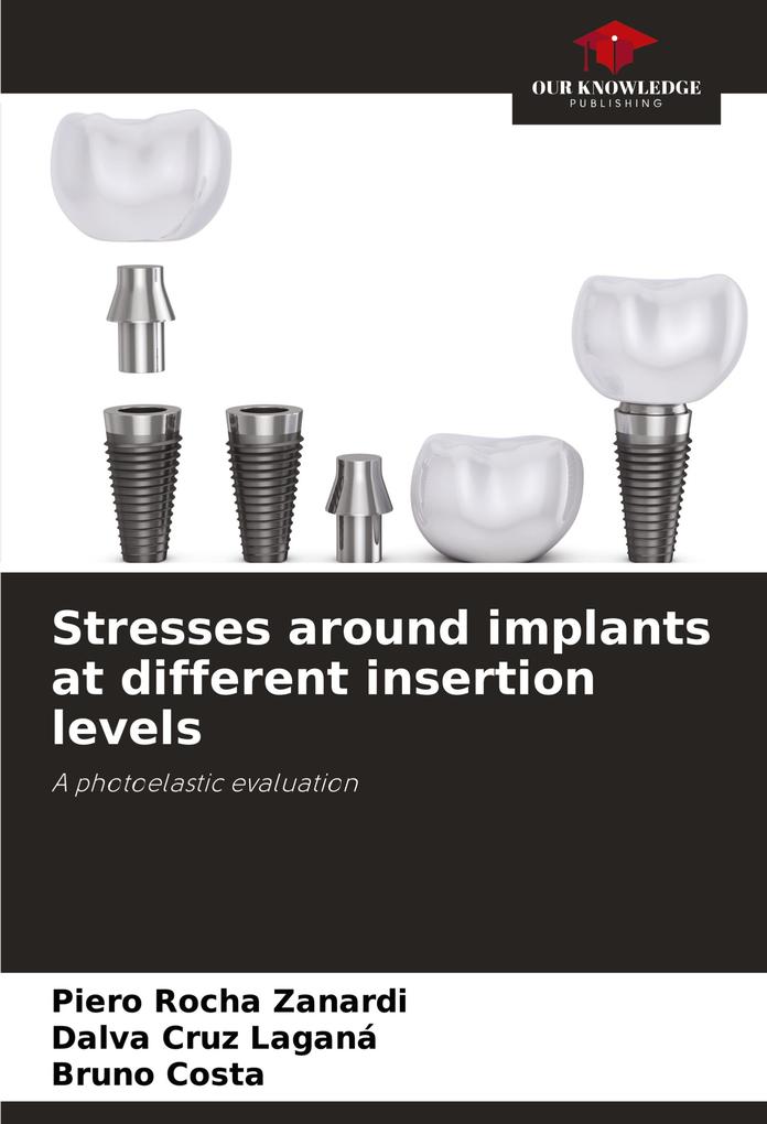 Stresses around implants at different insertion levels