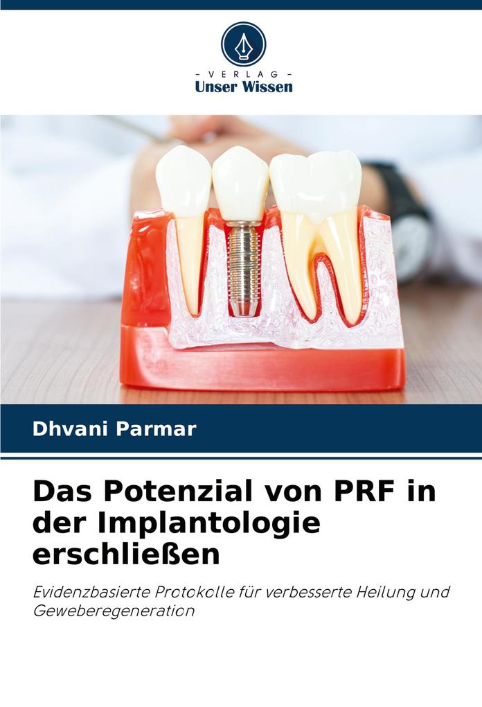 Das Potenzial von PRF in der Implantologie erschließen