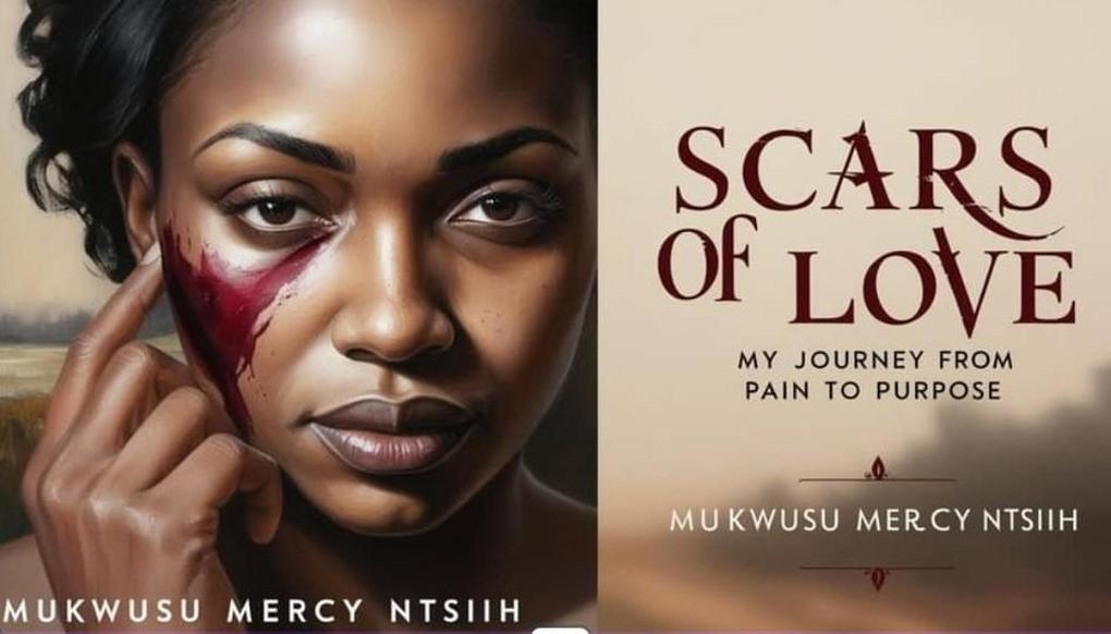 SCARS OF LOVE: My Journey from Pain to Purpose