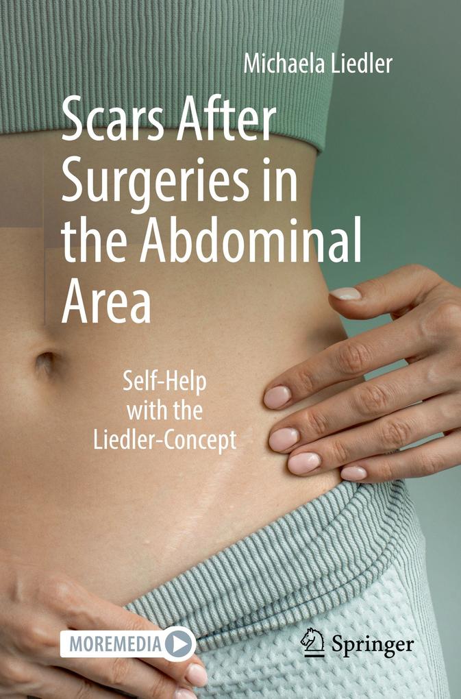 Scars After Surgeries in the Abdominal Area