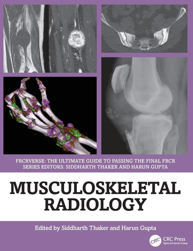Musculoskeletal Radiology