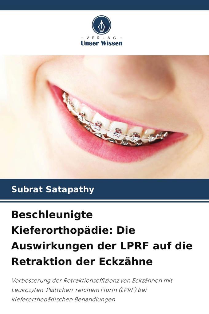 Beschleunigte Kieferorthopädie: Die Auswirkungen der LPRF auf die Retraktion der Eckzähne