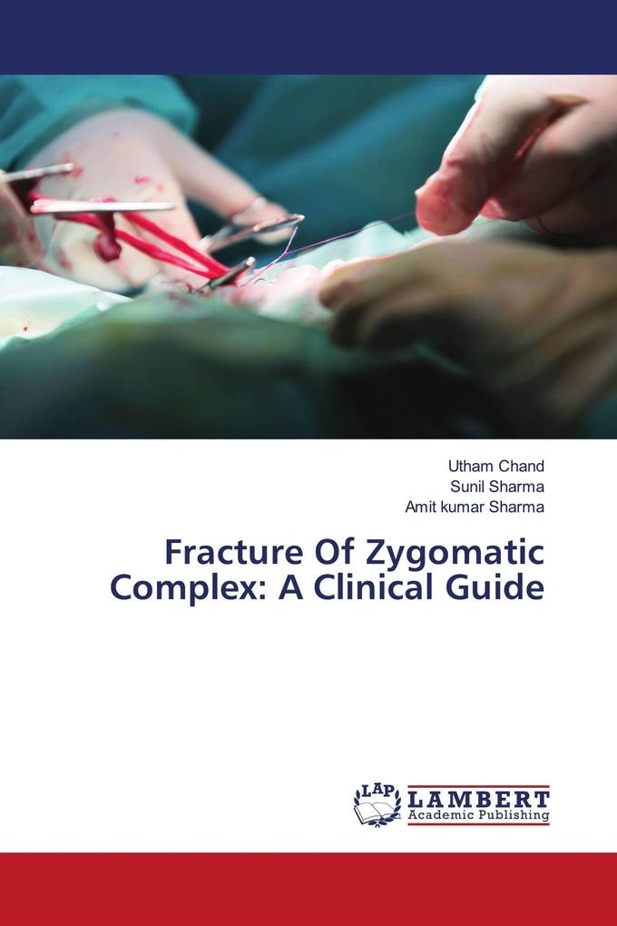 Fracture Of Zygomatic Complex: A Clinical Guide