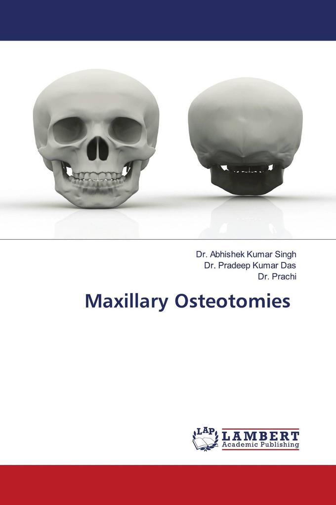 Maxillary Osteotomies