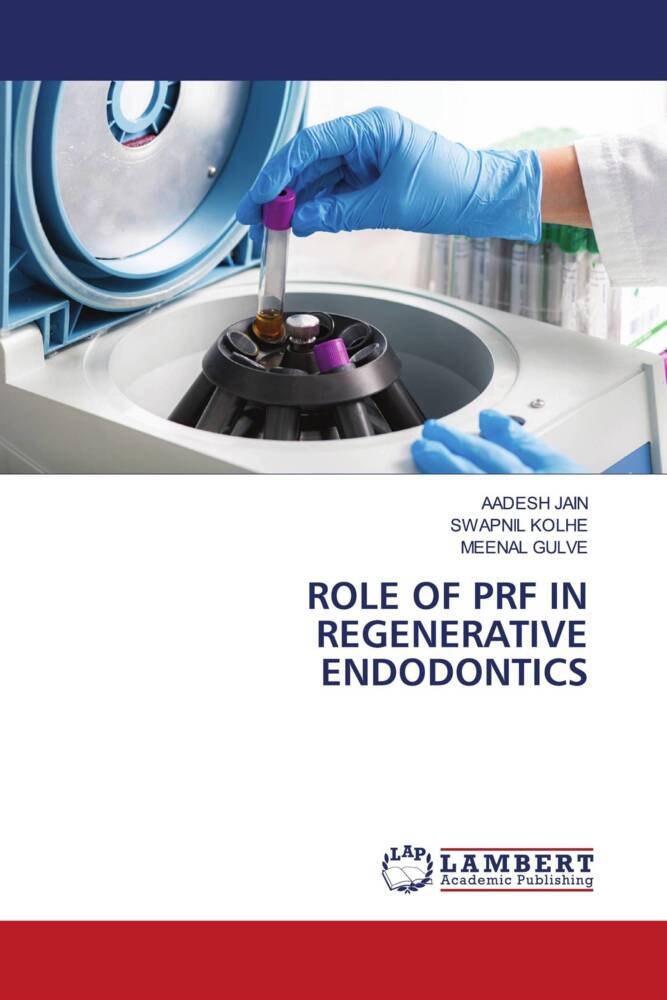 ROLE OF PRF IN REGENERATIVE ENDODONTICS