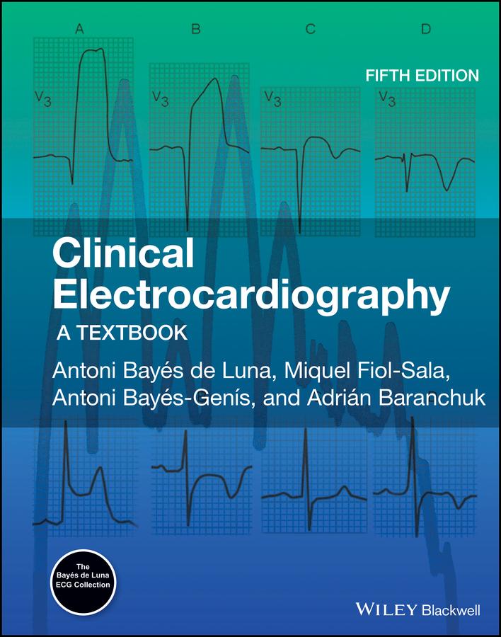 Clinical Electrocardiography