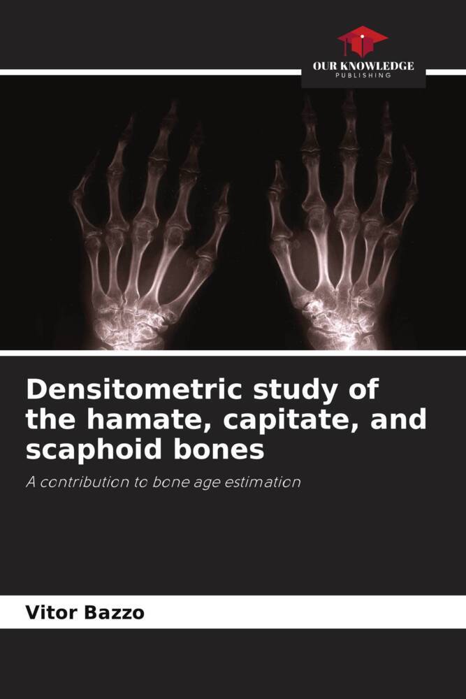Densitometric study of the hamate capitate and scaphoid bones
