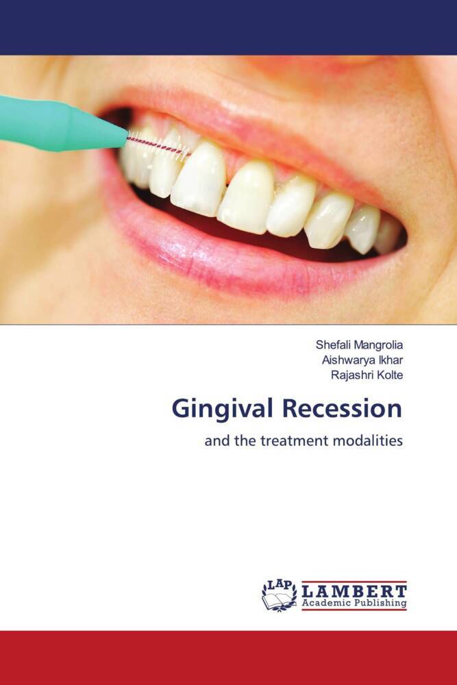 Gingival Recession