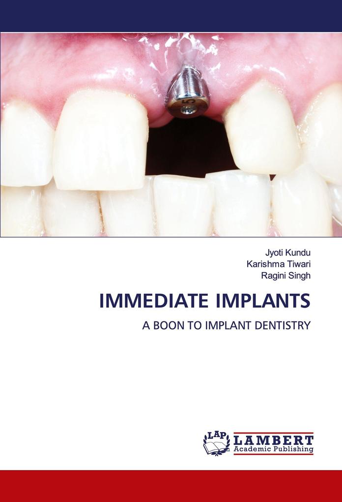 IMMEDIATE IMPLANTS