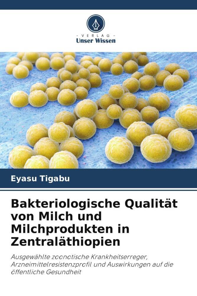 Bakteriologische Qualität von Milch und Milchprodukten in Zentraläthiopien