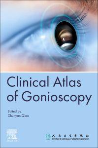 Clinical Atlas of Gonioscopy