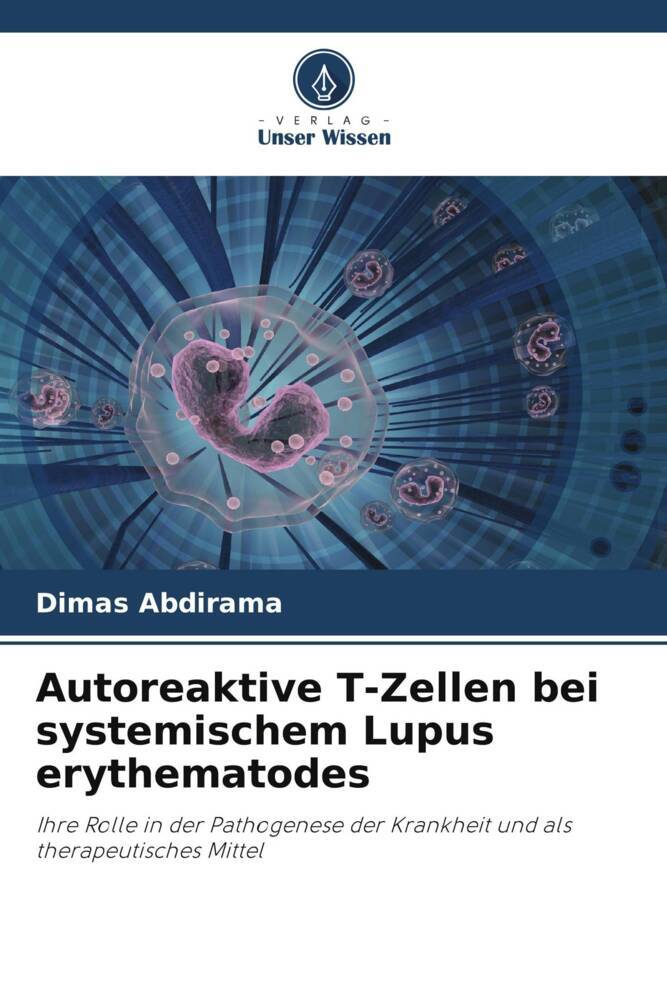 Autoreaktive T-Zellen bei systemischem Lupus erythematodes
