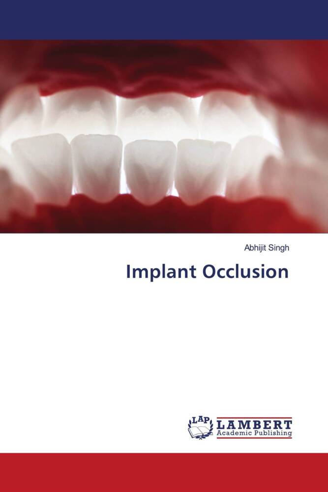 Implant Occlusion