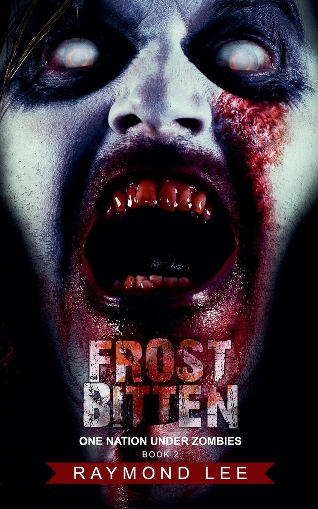 Frostbitten