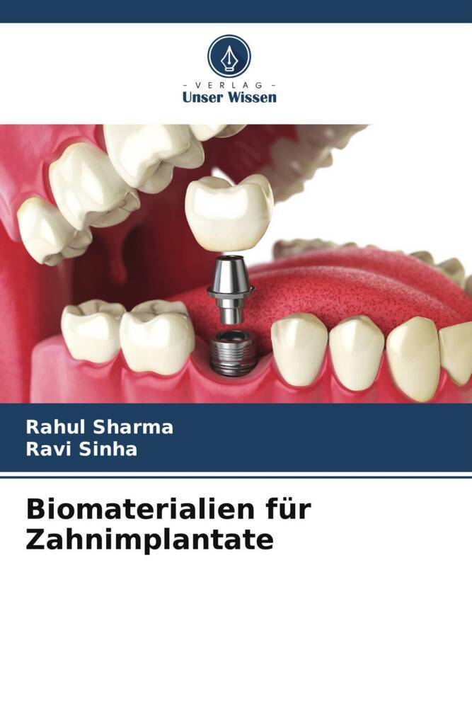 Biomaterialien für Zahnimplantate