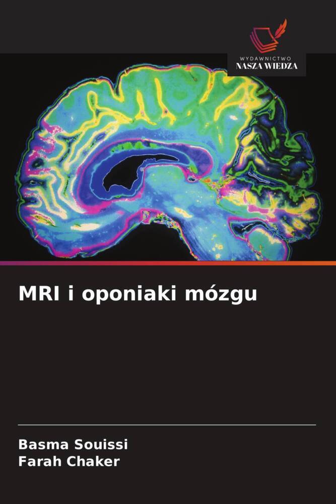 MRI i oponiaki mózgu