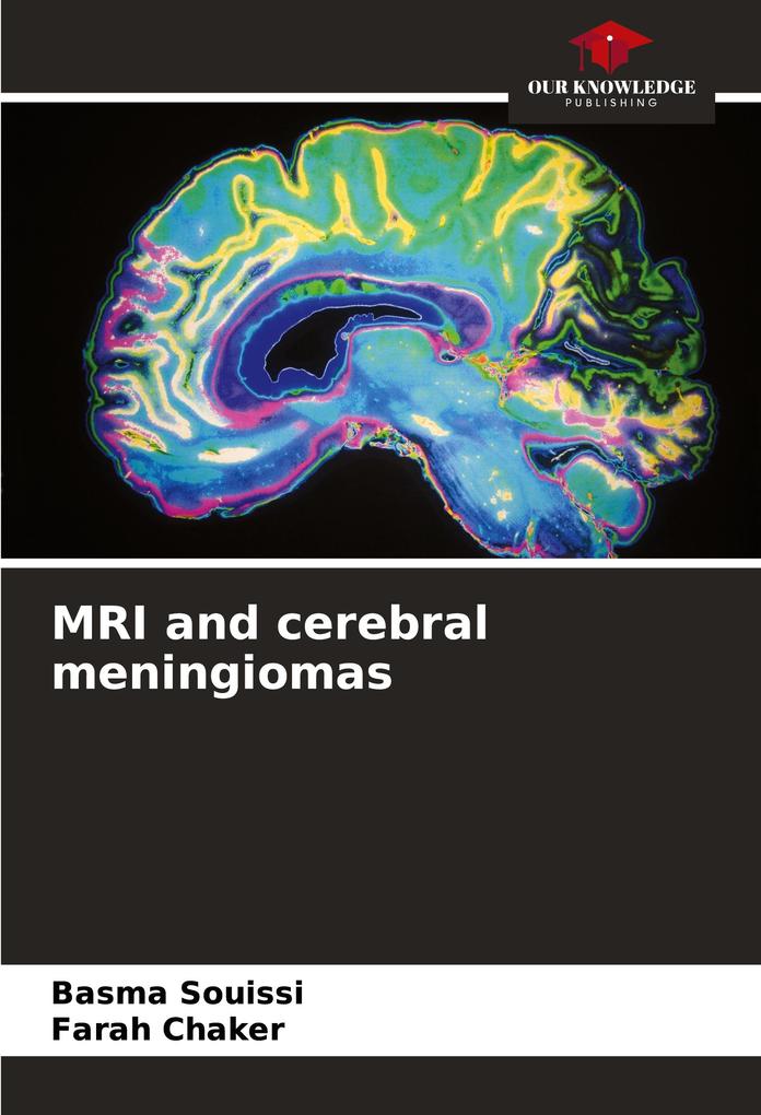 MRI and cerebral meningiomas