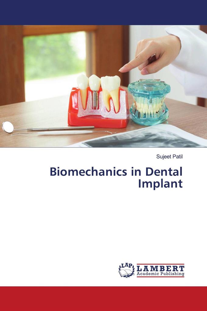 Biomechanics in Dental Implant
