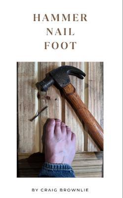 Hammer Nail Foot