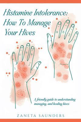 Histamine Intolerance: How To Manage Your Hives: A friendly guide to understanding managing and healing hives: How To Manage Your Hives: