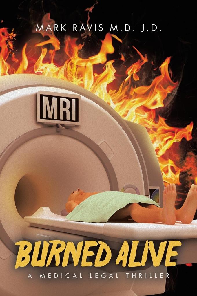 Burned Alive