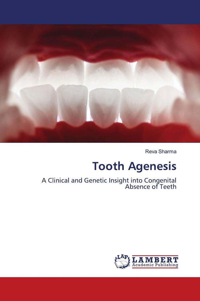 Tooth Agenesis
