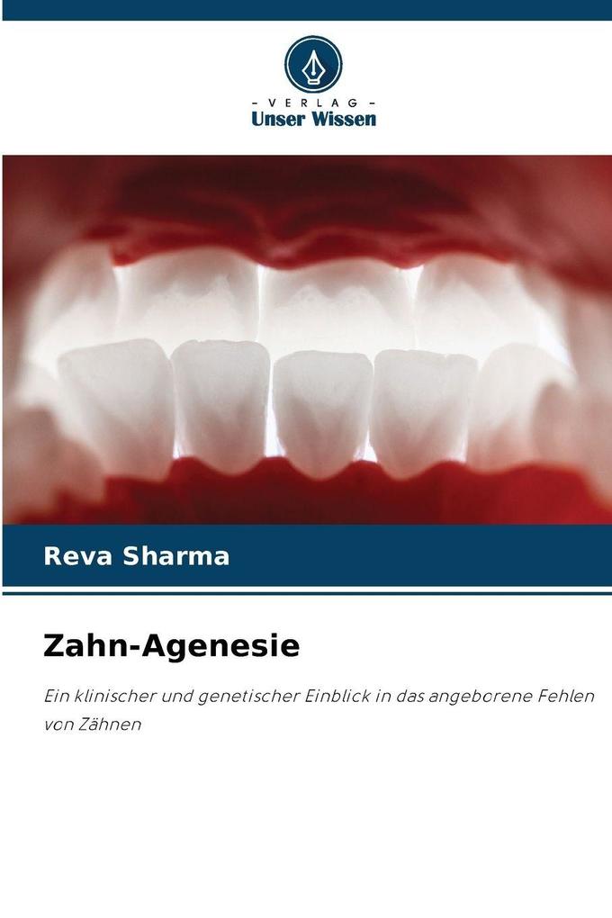 Zahn-Agenesie