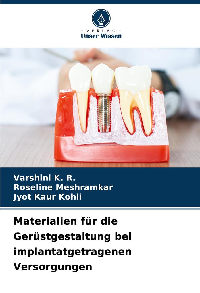 Materialien für die Gerüstgestaltung bei implantatgetragenen Versorgungen