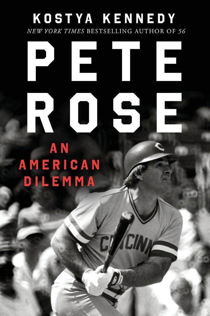 Pete Rose