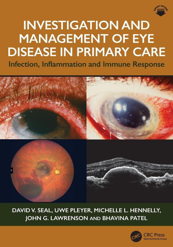 Investigation & Management of Eye Disease in Primary Care