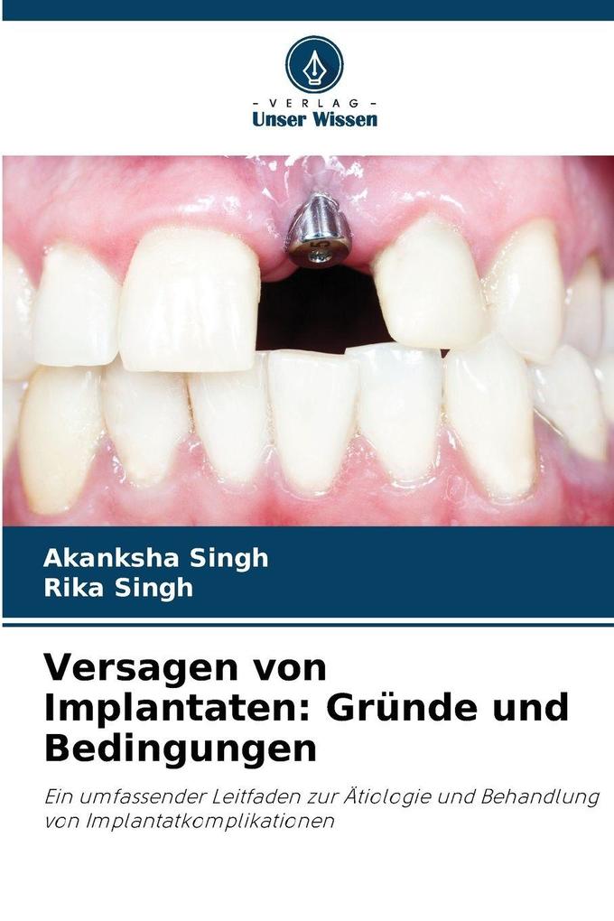 Versagen von Implantaten: Gründe und Bedingungen