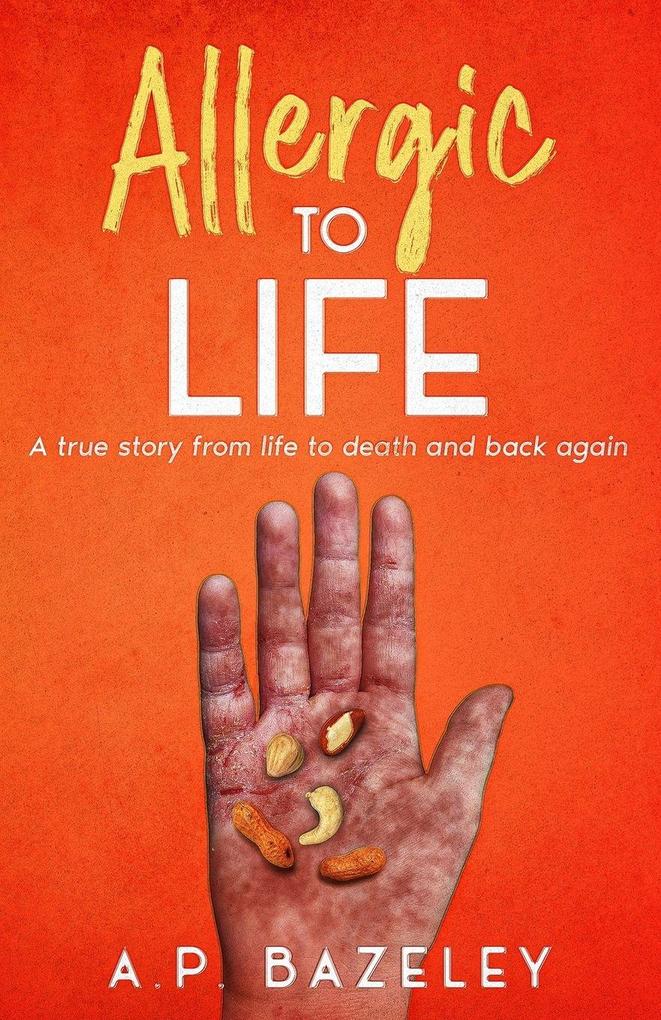 Allergic To Life