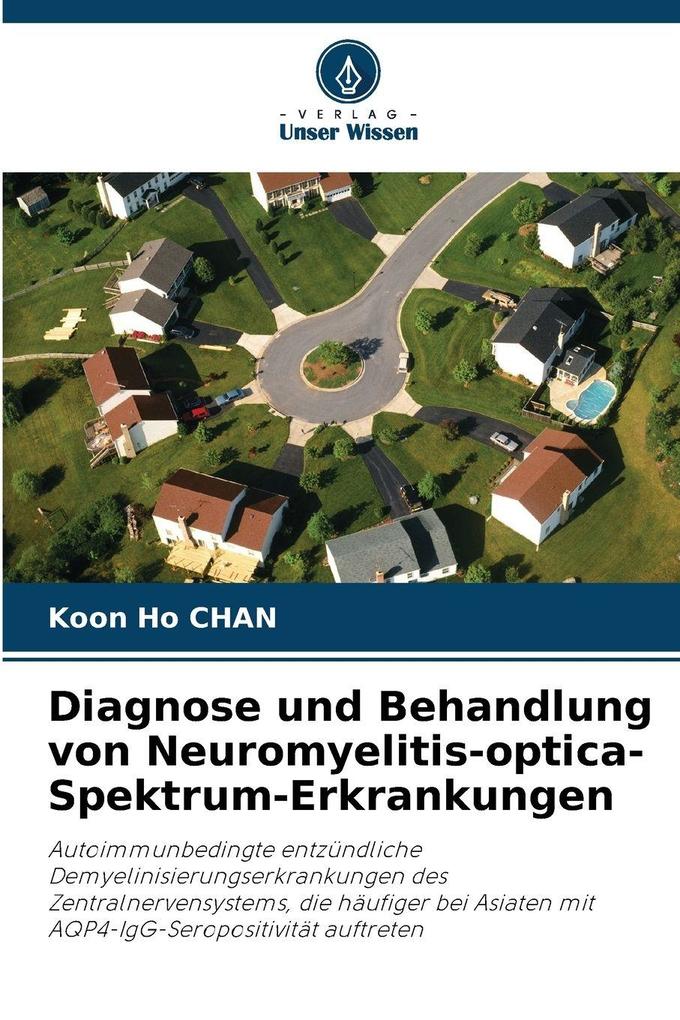 Diagnose und Behandlung von Neuromyelitis-optica-Spektrum-Erkrankungen