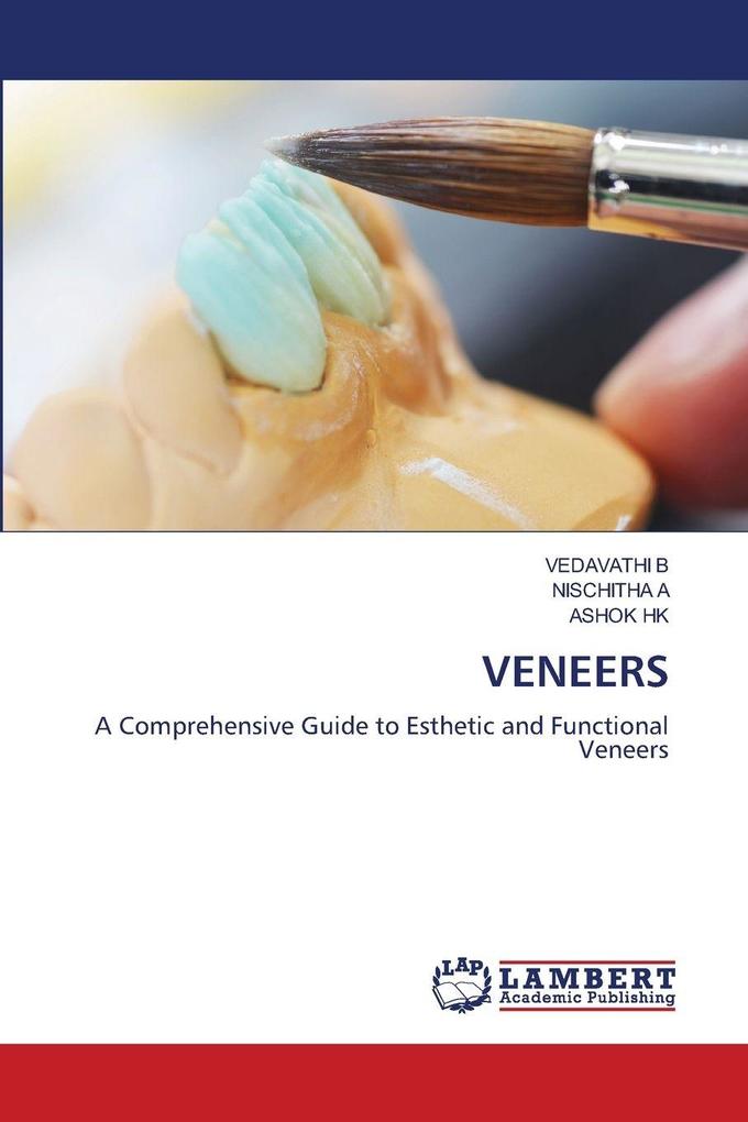 VENEERS
