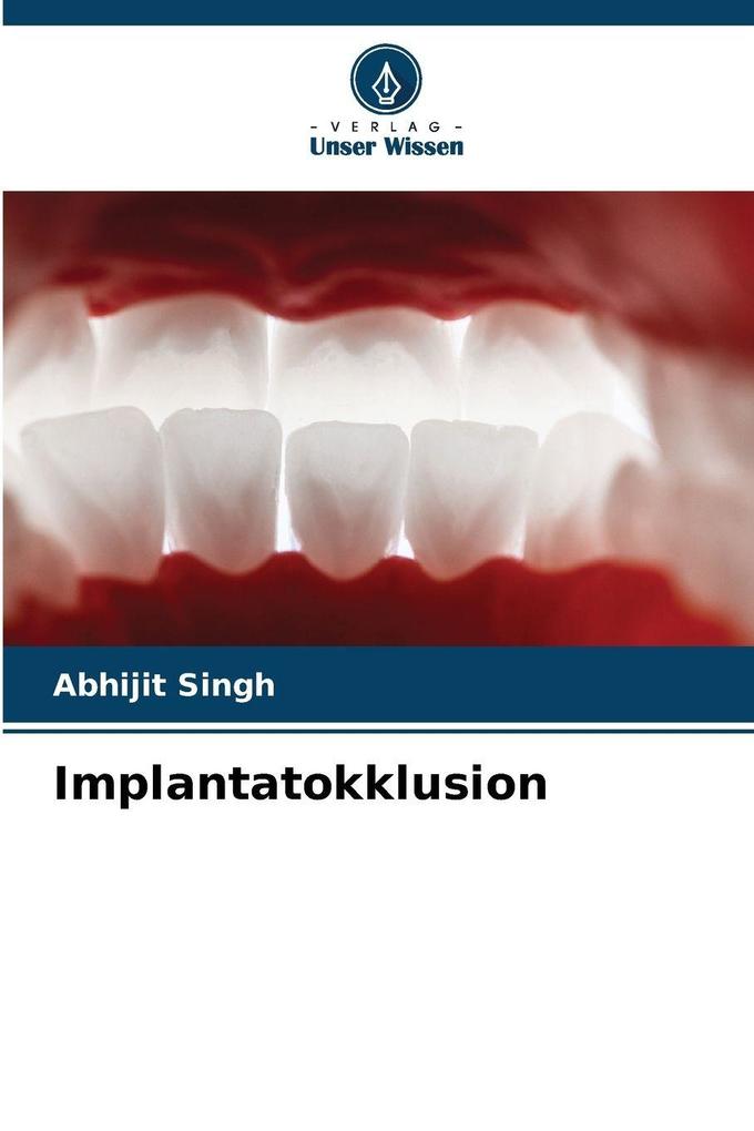 Implantatokklusion