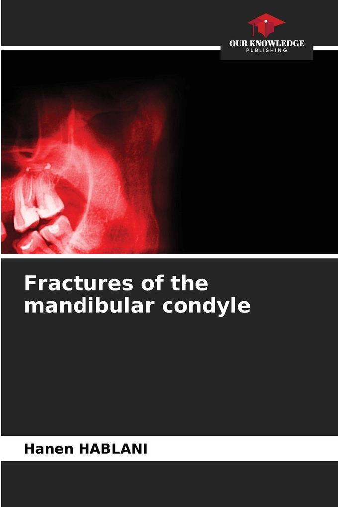 Fractures of the mandibular condyle