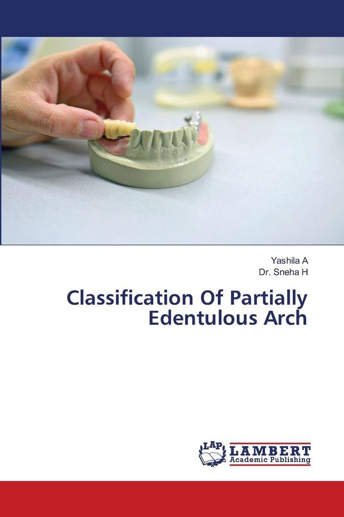 Classification Of Partially Edentulous Arch