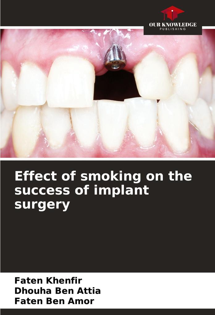 Effect of smoking on the success of implant surgery