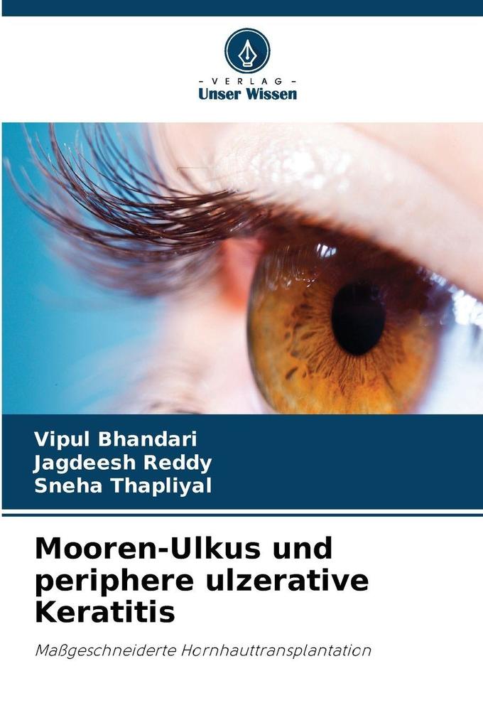 Mooren-Ulkus und periphere ulzerative Keratitis