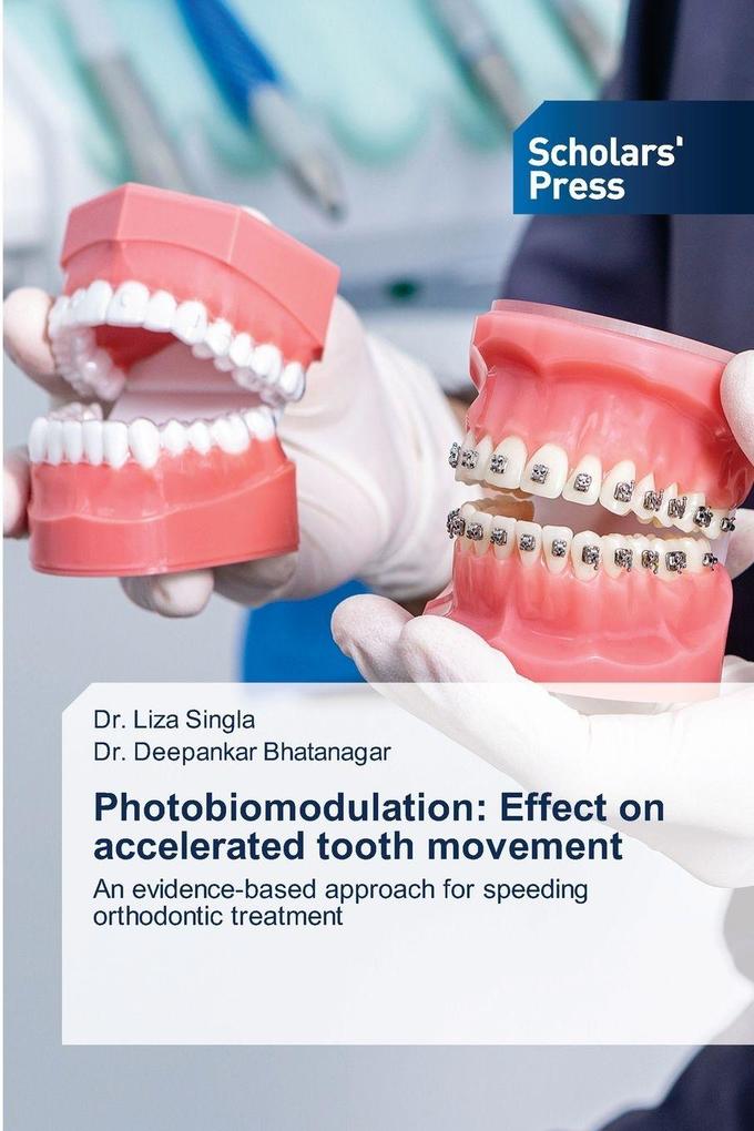 Photobiomodulation: Effect on accelerated tooth movement