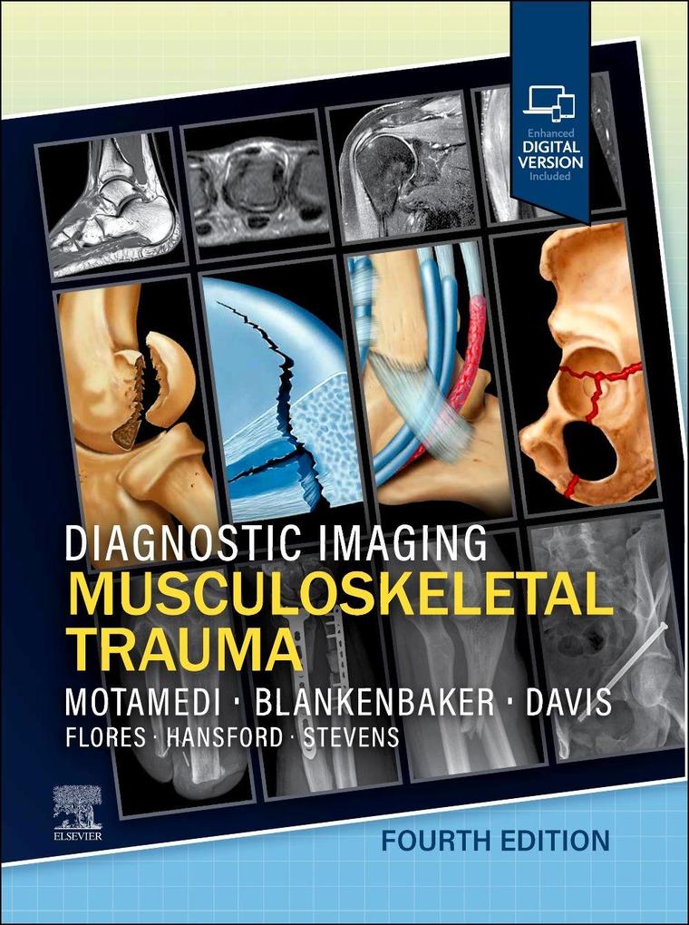 Diagnostic Imaging: Musculoskeletal Trauma