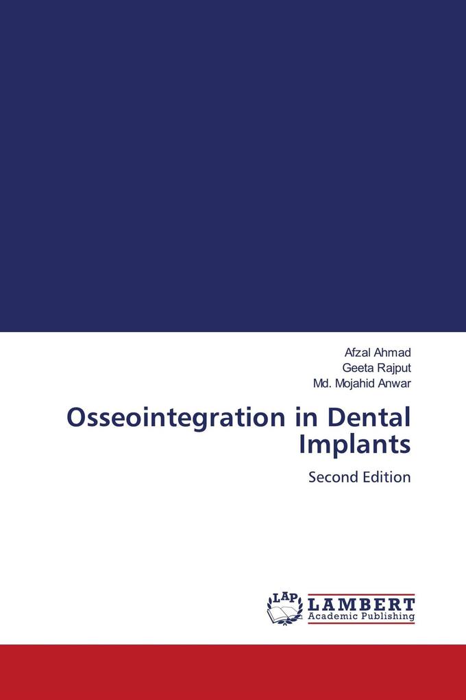 Osseointegration in Dental Implants