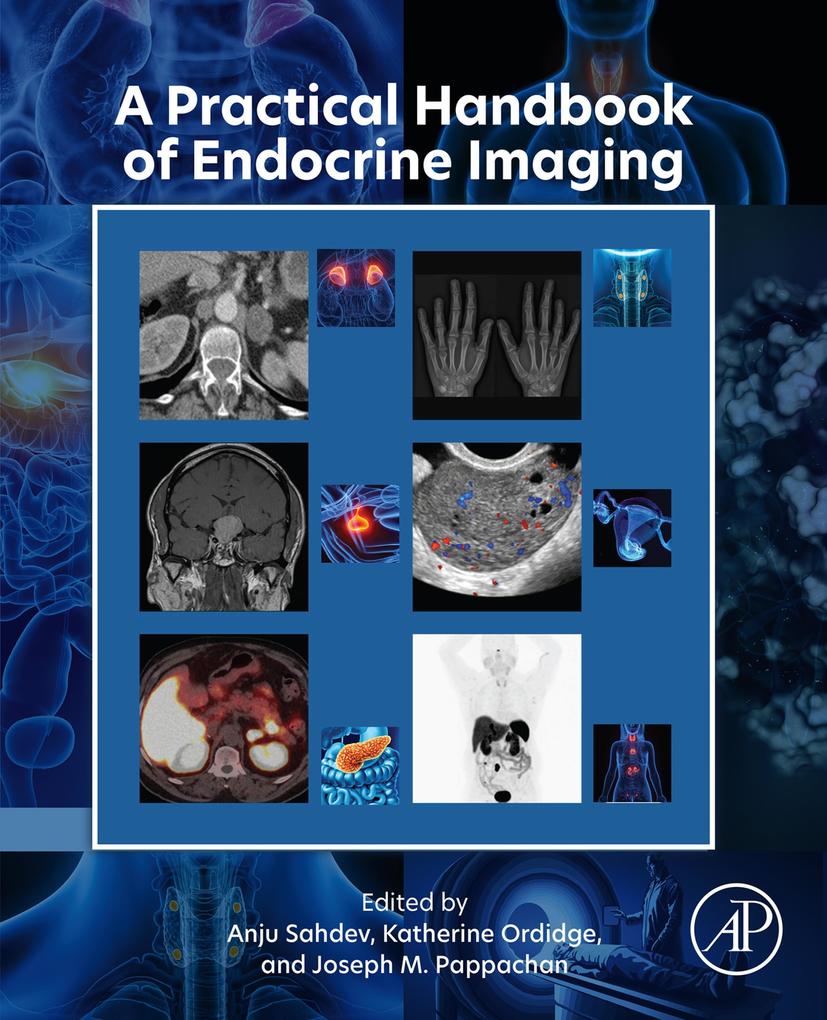 A Practical Handbook of Endocrine Imaging