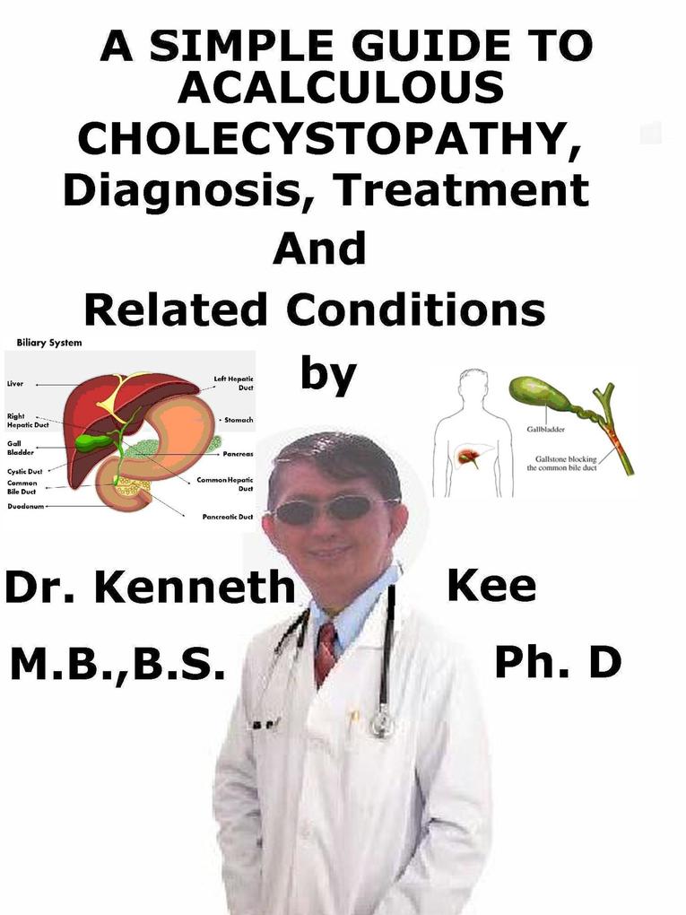A Simple Guide to Acalculous Cholecystopathy Diagnosis Treatment and Related Conditions