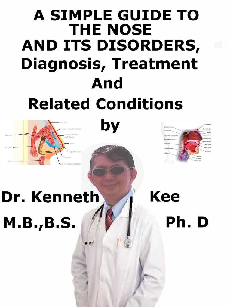 A Simple Guide to the Nose and Its Disorders Diagnosis Treatment and Related Conditions