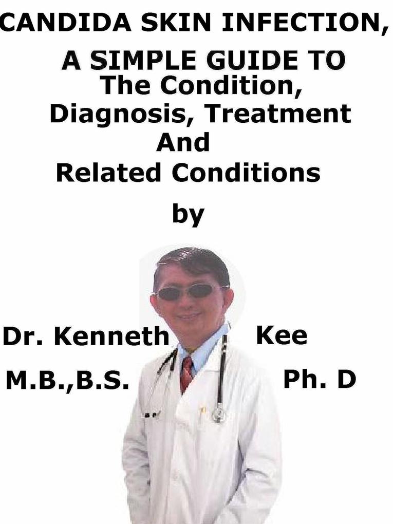 Candida Skin Infection A Simple Guide To The Condition Diagnosis Treatment And Related Conditions