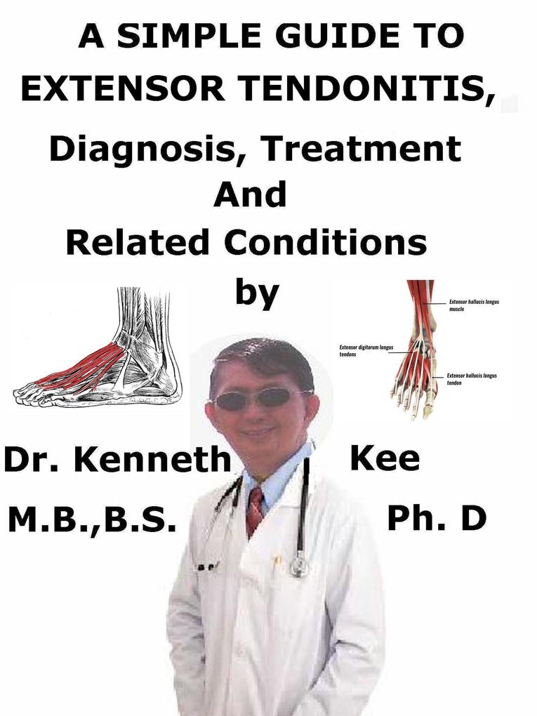 A Simple Guide to Extensor Tendonitis Diagnosis Treatment and Related Conditions