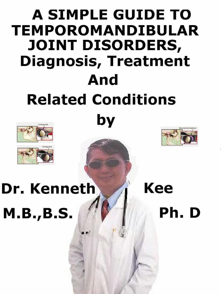 A Simple Guide to Temporomandibular Joint Disorders Diagnosis Treatment and Related Conditions