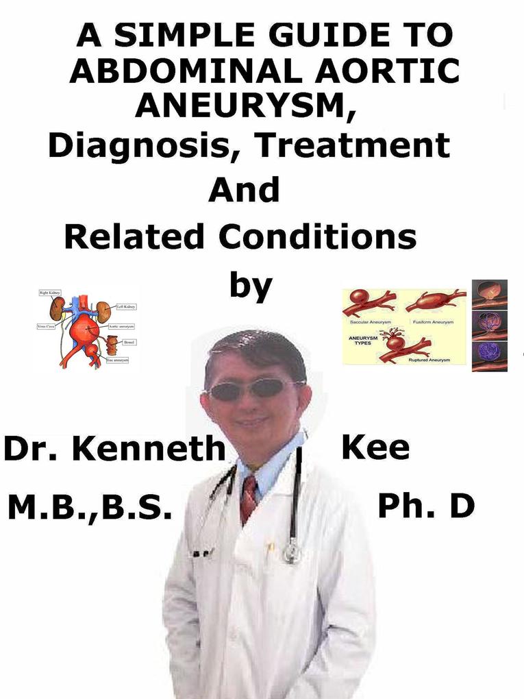 A Simple Guide to Abdominal Aortic Aneurysm Diagnosis Treatment and Related Conditions